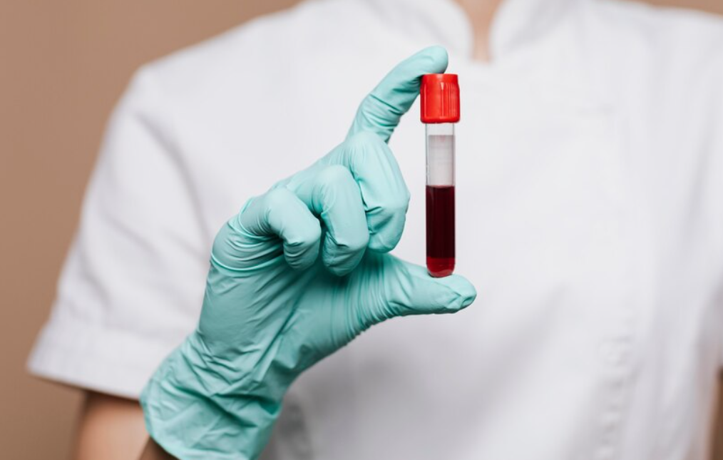 Blood Test