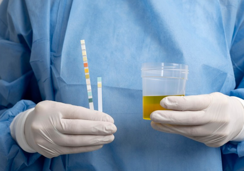 Urine Test