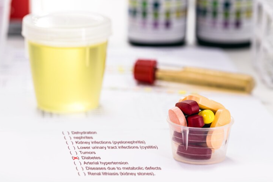 Diabetes Test