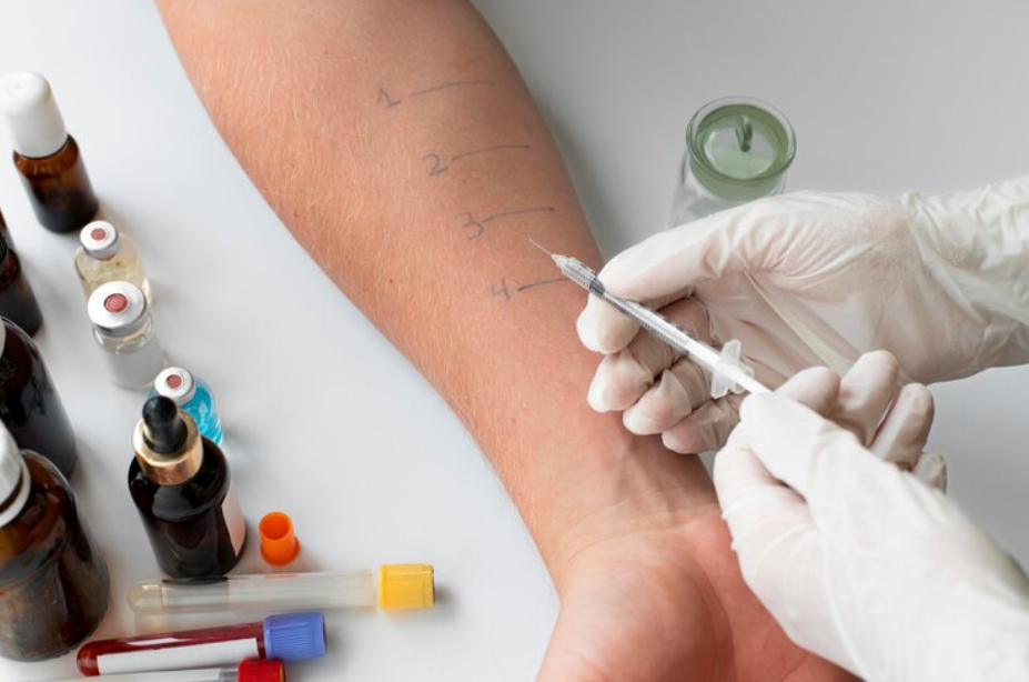 Allergy Test