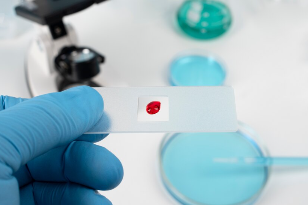 Hepatitis Test